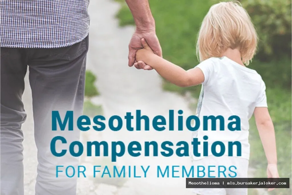 Mesothelioma compensation for family members