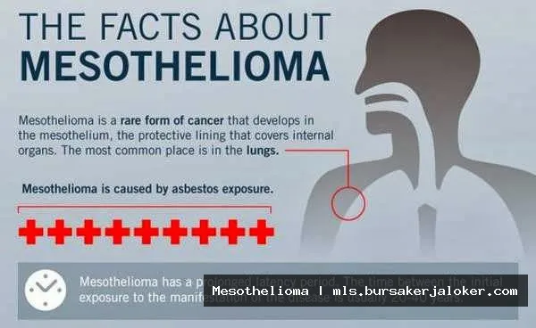 Mesothelioma facts: Important information graphic.