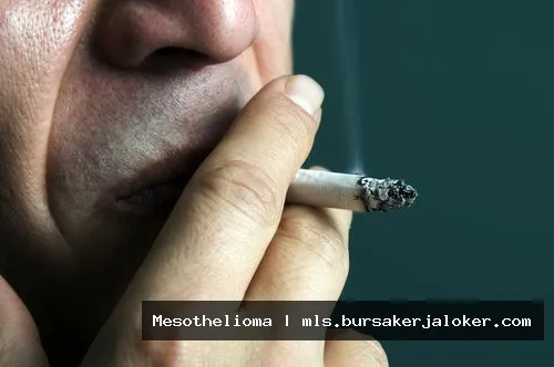 Mesothelioma from smoking: Lung illustration.