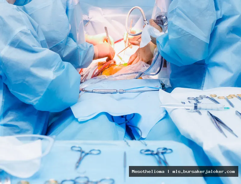 Mesothelioma HIPEC: Surgical treatment option.