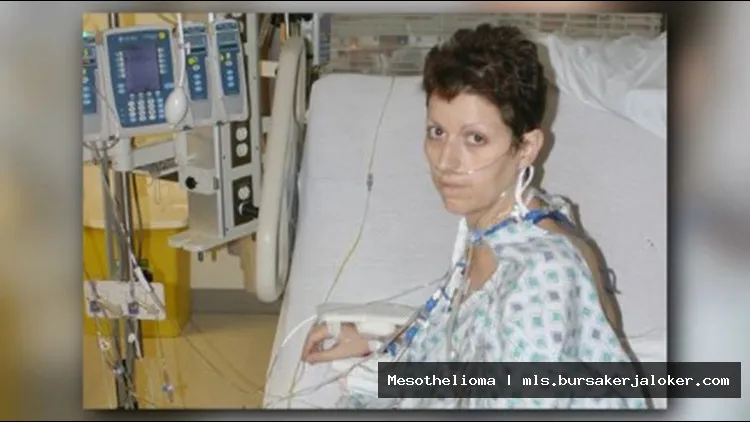Mesothelioma patient seeking support group.