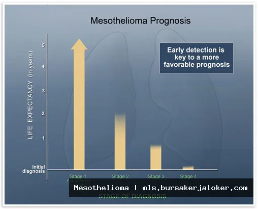 Mesothelioma prognosis: Factors affecting survival.
