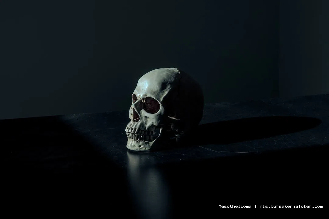 Mesothelioma stage 4 life expectancy chart.