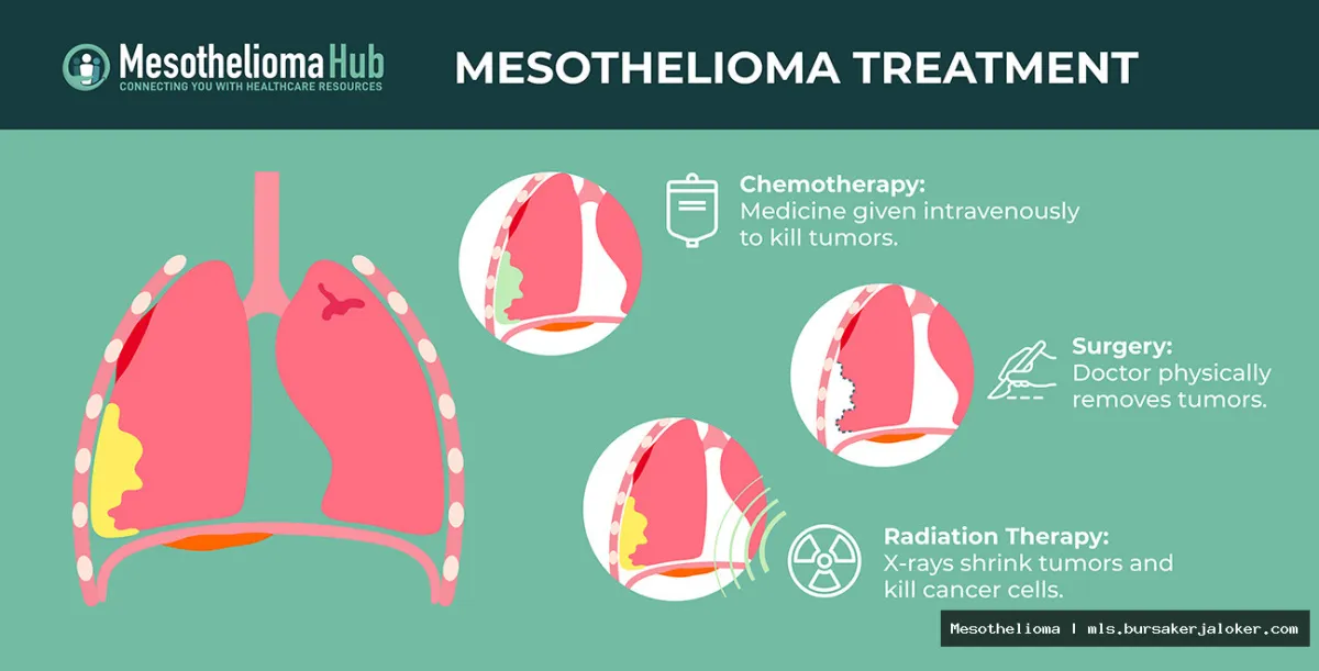 Mesothelioma treatment options, explained simply.