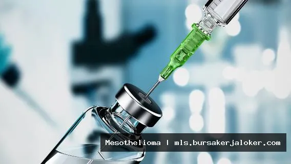 Mesothelioma vaccine: Hope for patients